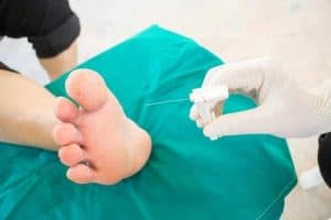 רגל סוכרתית