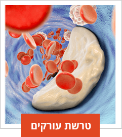 ליקוריץ טרשת עורקים