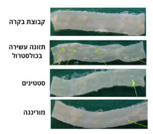 ההשפעות המעכבות של תמצית עלה מורינגה לעומת סטטינים על היווצרות הפלאק בעורקי הצוואר הפנימיים